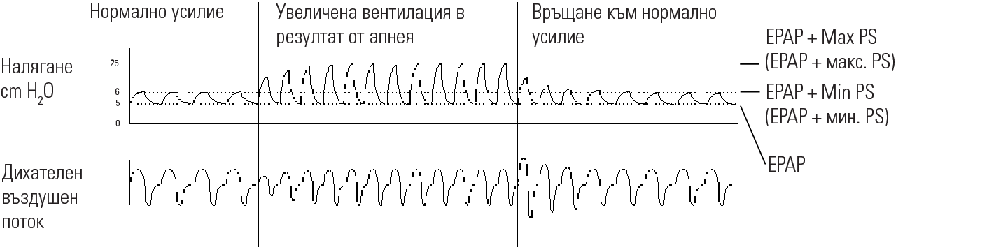 RE_therapy-info_graph-asv-pressure-support_col.png