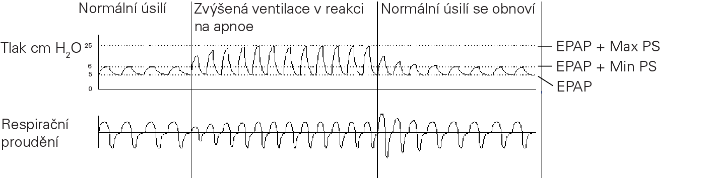 RE_therapy-info_graph-asv-pressure-support_col.png