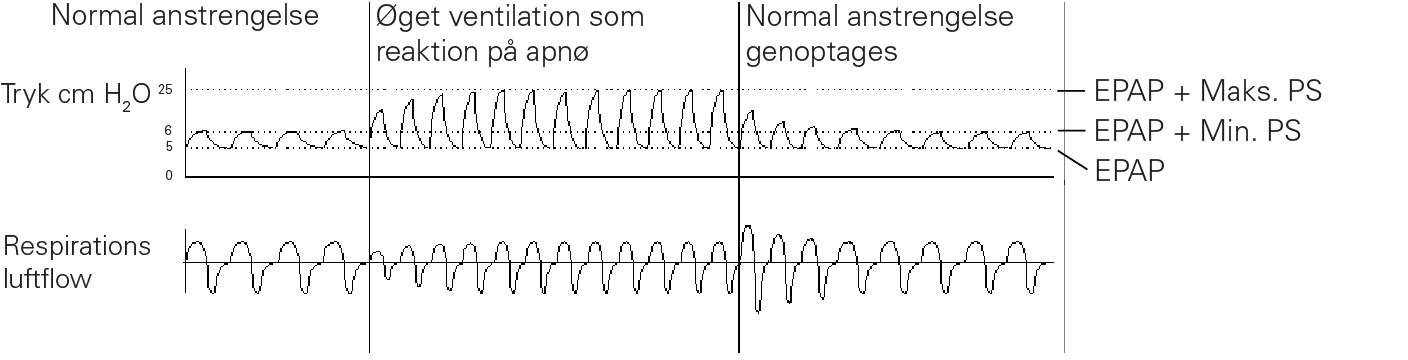 RE_therapy-info_graph-asv-pressure-support_col.png
