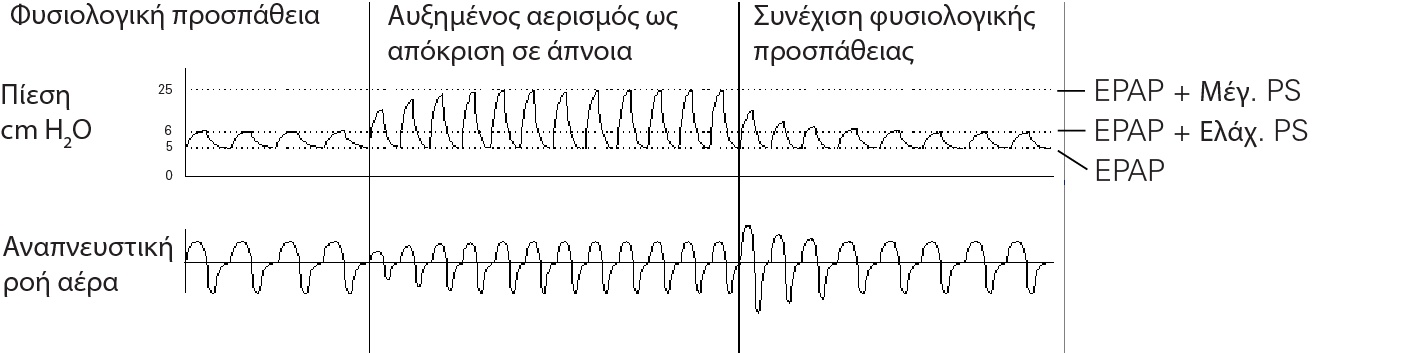 RE_therapy-info_graph-asv-pressure-support_col.png