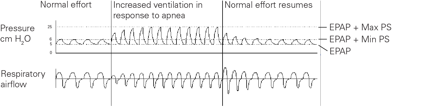 RE_therapy-info_graph-asv-pressure-support_col.png