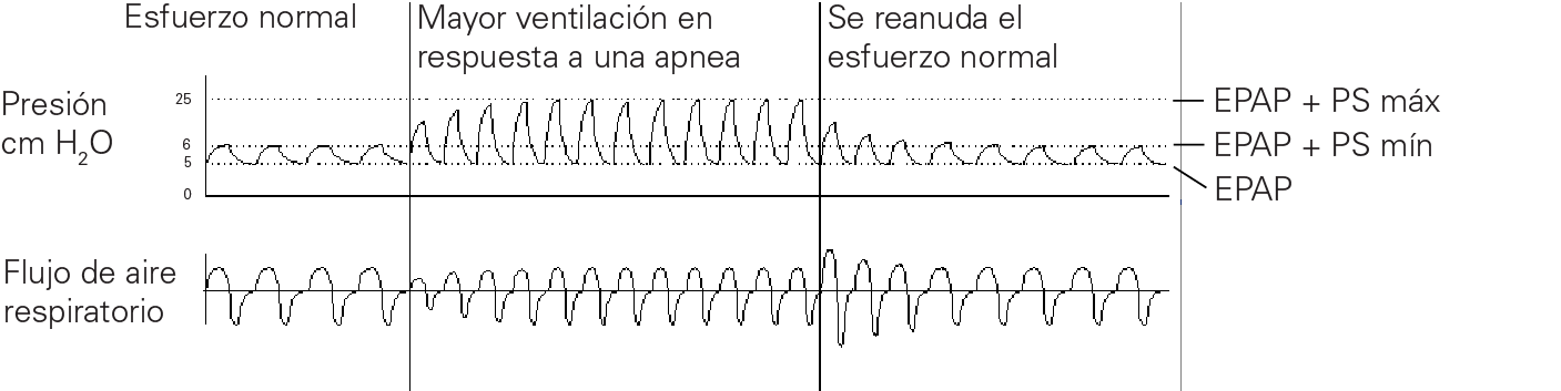 RE_therapy-info_graph-asv-pressure-support_col.png