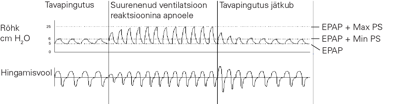 RE_therapy-info_graph-asv-pressure-support_col.png