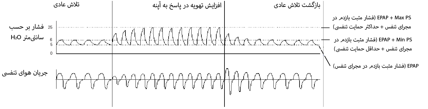 RE_therapy-info_graph-asv-pressure-support_col.png