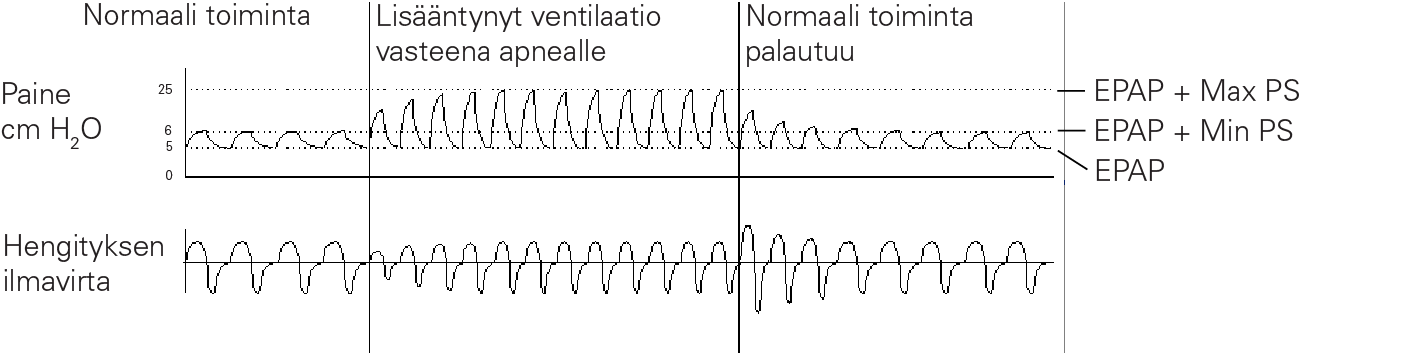 RE_therapy-info_graph-asv-pressure-support_col.png