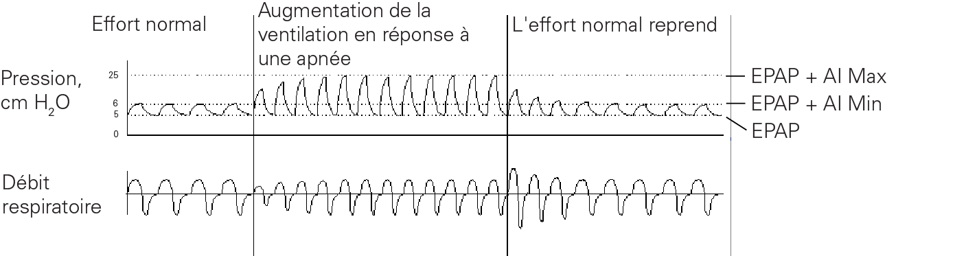 RE_therapy-info_graph-asv-pressure-support_col.png