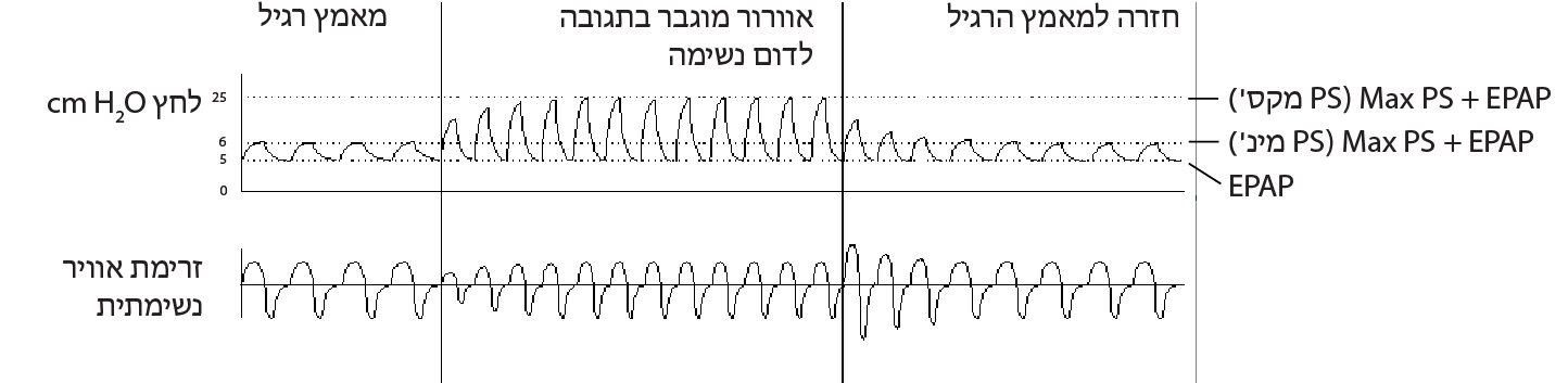 RE_therapy-info_graph-asv-pressure-support_col.png