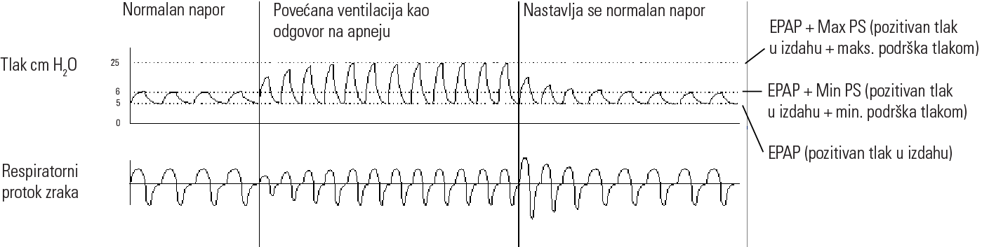 RE_therapy-info_graph-asv-pressure-support_col.png