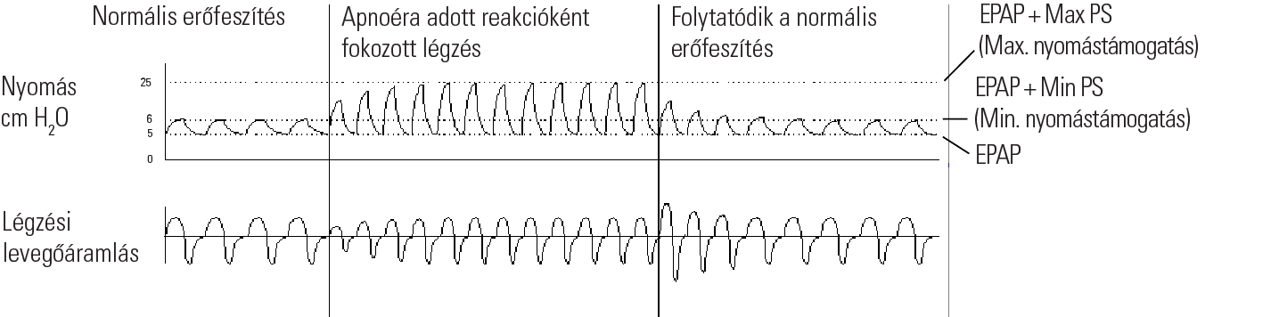 RE_therapy-info_graph-asv-pressure-support_col.png