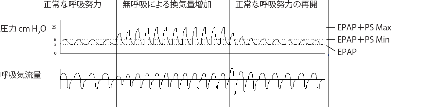 RE_therapy-info_graph-asv-pressure-support_col.png