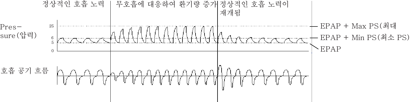 RE_therapy-info_graph-asv-pressure-support_col.png