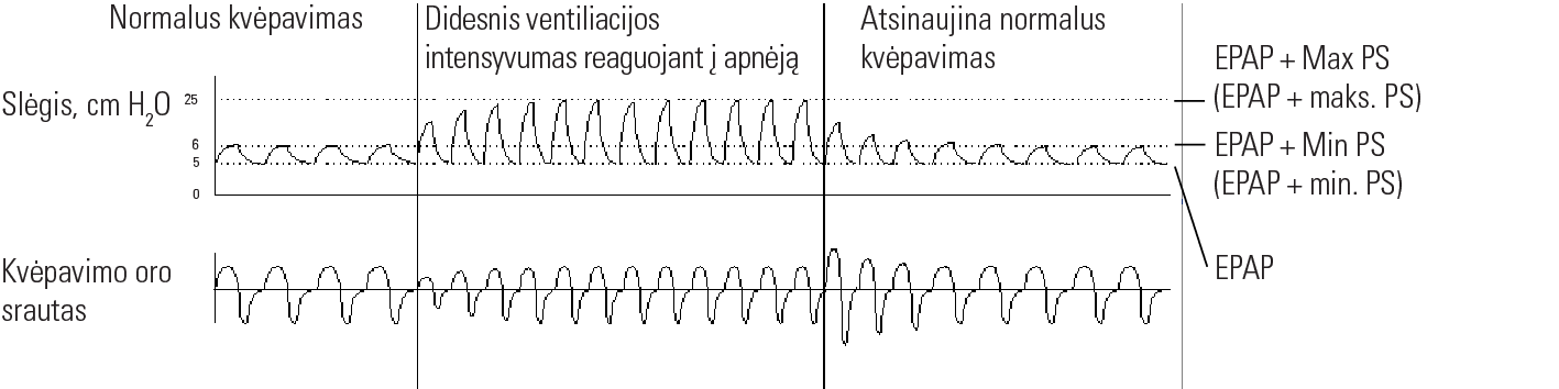 RE_therapy-info_graph-asv-pressure-support_col.png