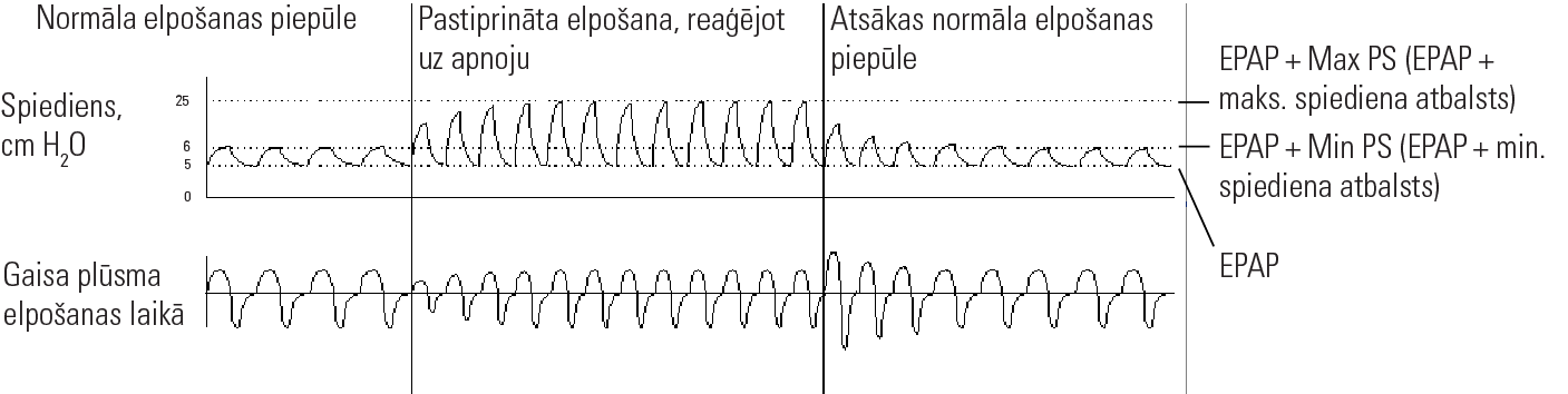 RE_therapy-info_graph-asv-pressure-support_col.png