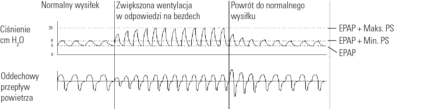 RE_therapy-info_graph-asv-pressure-support_col.png