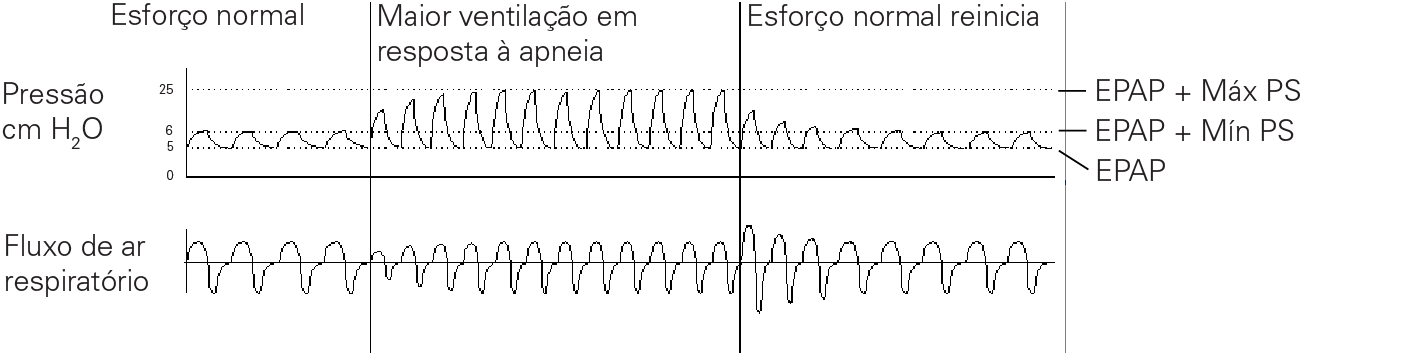 RE_therapy-info_graph-asv-pressure-support_col.png