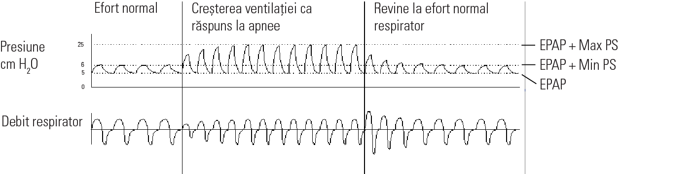 RE_therapy-info_graph-asv-pressure-support_col.png