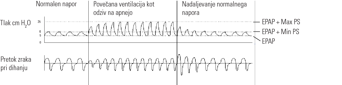 RE_therapy-info_graph-asv-pressure-support_col.png