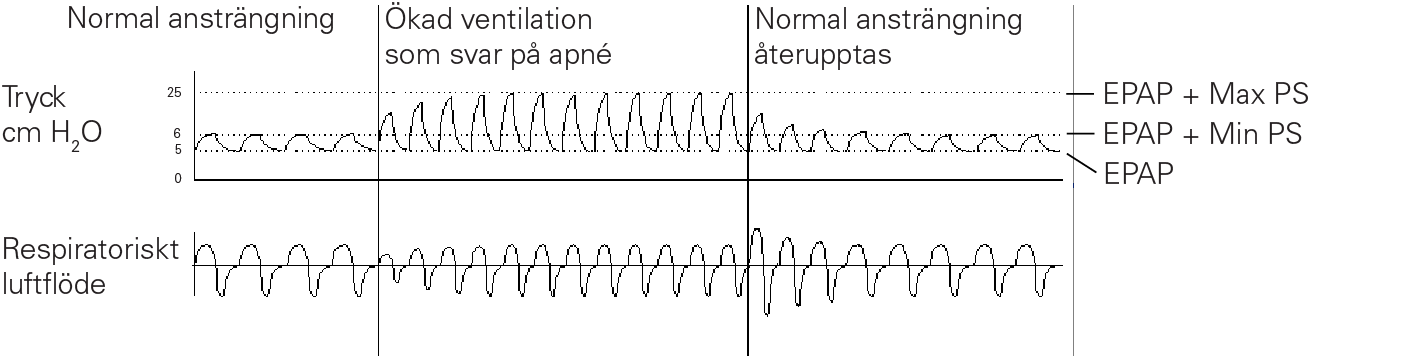 RE_therapy-info_graph-asv-pressure-support_col.png