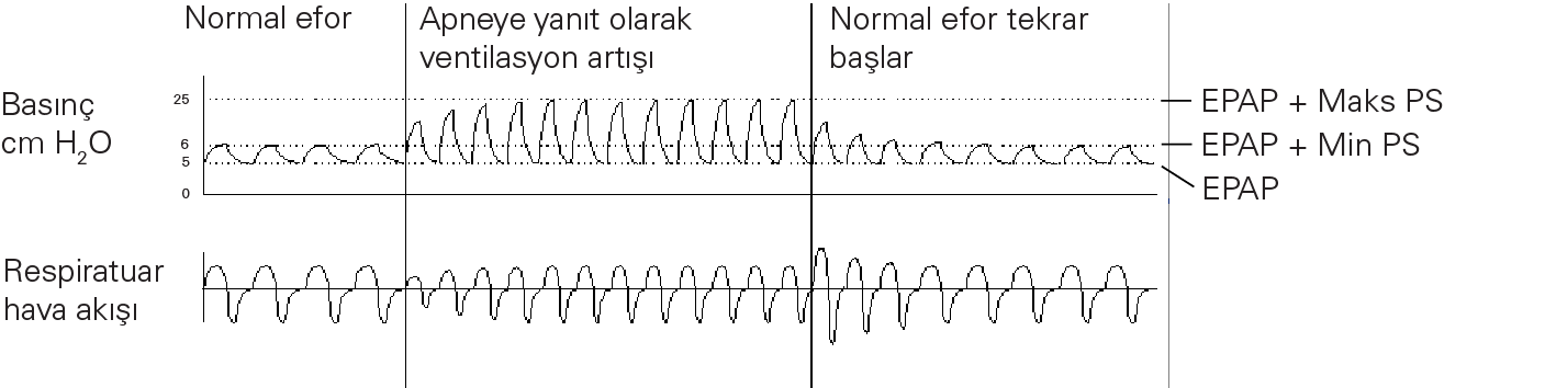 RE_therapy-info_graph-asv-pressure-support_col.png