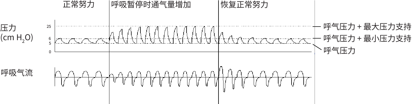 RE_therapy-info_graph-asv-pressure-support_col.png
