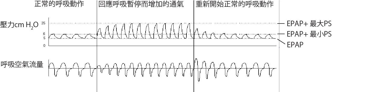 RE_therapy-info_graph-asv-pressure-support_col.png